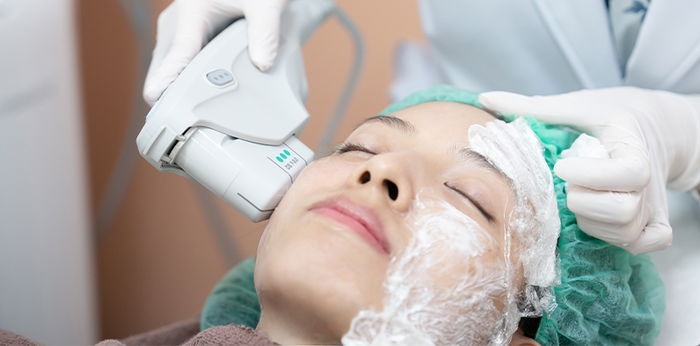 Ulthera คืออะไร ? อัลเทอร่า ดีจริงไหม สาว ๆ อยากรู้ต้องอ่าน !