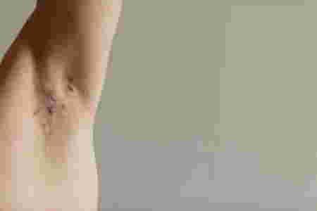 armpit bumps during pregnancy