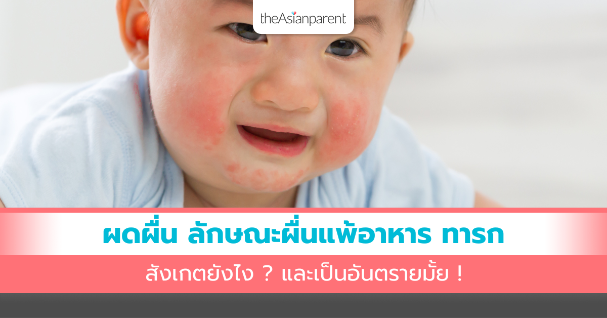 Tin Food Rash ผดผื่น ลักษณะผื่นแพ้อาหาร ทารก สังเกตยังไง ? และเป็นอันตรายมั้ย
