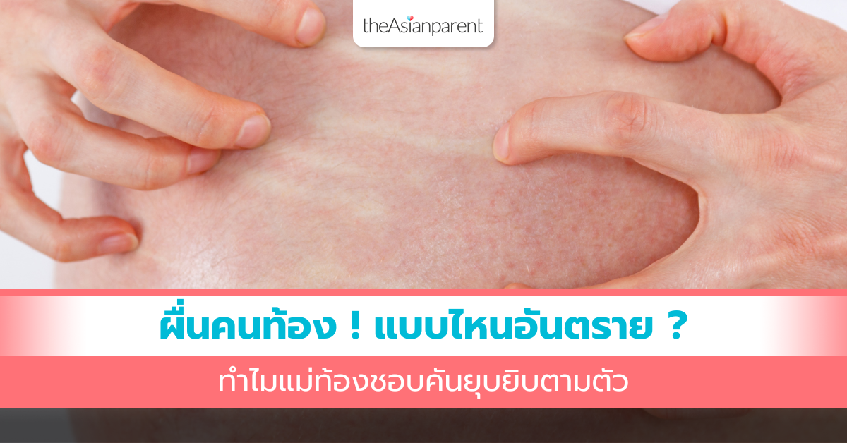 ผื่นคนท้อง! แบบไหนอันตราย ? ทำไมแม่ท้องชอบคันยุบยิบตามตัว
