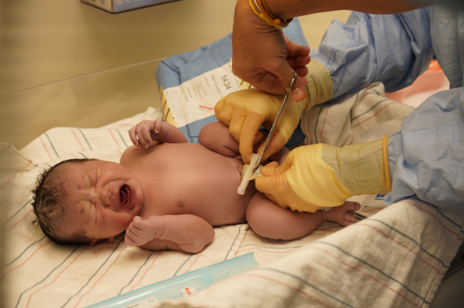 เด็กผ่าคลอด