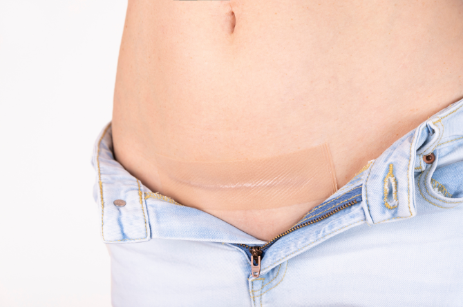 การดูแลตัวเองหลังผ่าคลอด