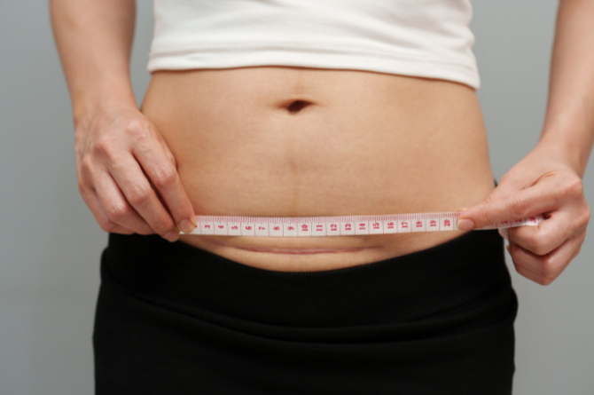 ลักษณะแผลผ่าคลอด