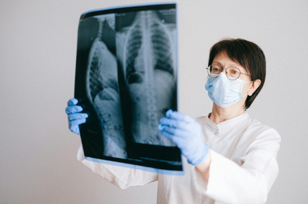 lung cancer on women