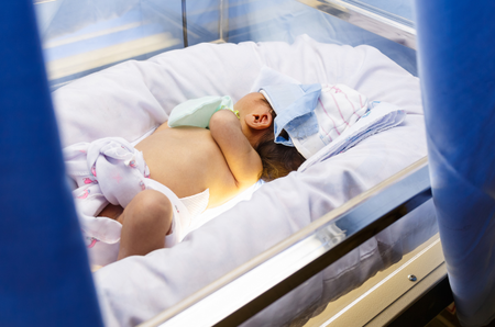 newborn jaundice