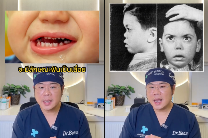 โรคขาดาบ