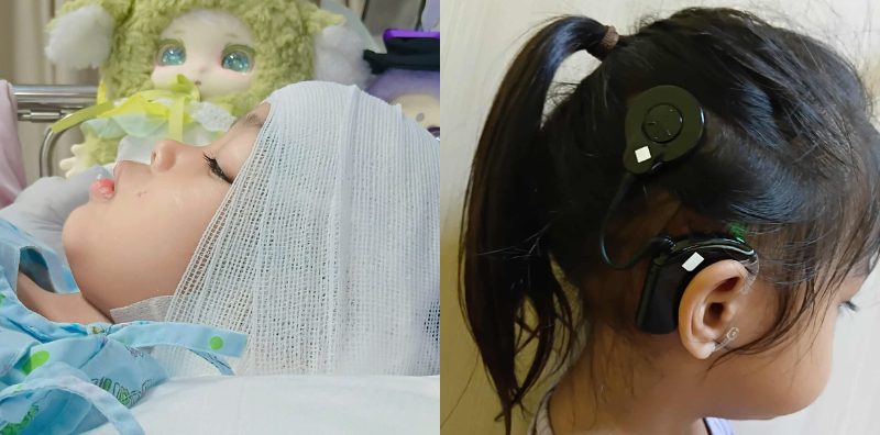 แม่โพสต์! ลูกเป็นหวัดนาน ป่วยบ่อย อย่าชะล่าใจ สุดท้ายสูญเสียการได้ยิน