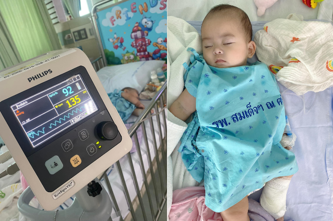 อุทาหรณ์ลูกเป็นหวัด