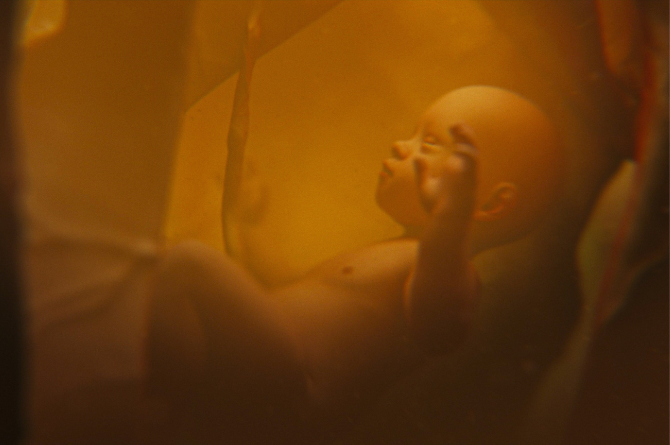 ทารกกลืนน้ำคร่ำอันตรายไหม