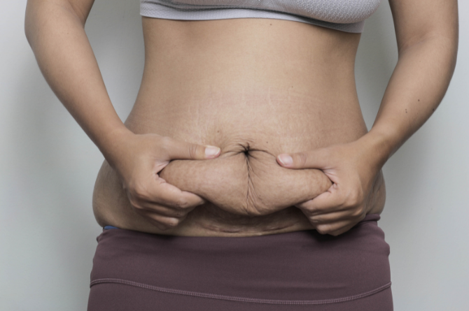 การฟื้นตัวหลังคลอด