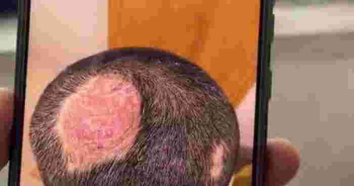 เชื้อราจากกระต่าย