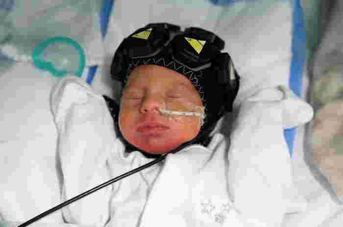 หมวกสแกนสมองทารก