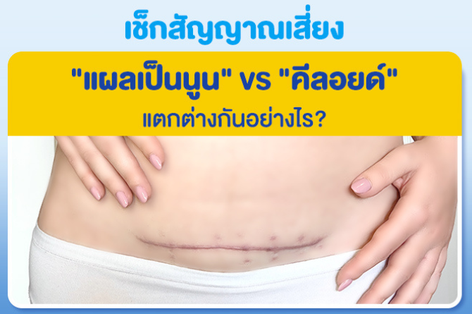 แผลผ่าคลอด