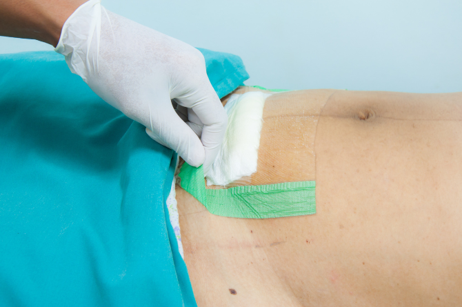 แม่มีไข้หลังผ่าคลอด