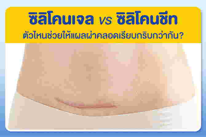 ซิลิโคนเจล (SILICONE GEL)