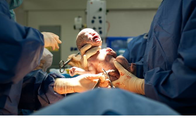 ผ่าคลอด