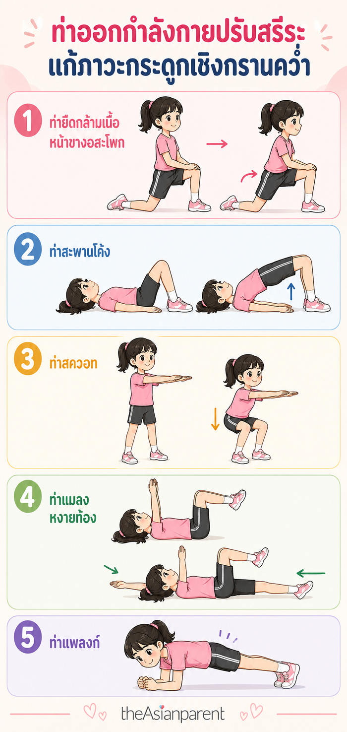ท่าออกกำลังกาย ปรับสรีระ ภาวะกระดูกเชิงกรานคว่ำ ไปข้างหน้า