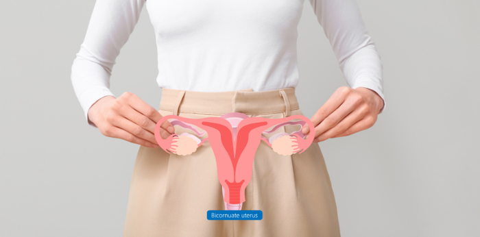 มดลูกรูปหัวใจ (Bicornuate Uterus) คืออะไร? ส่งผลต่อการตั้งครรภ์อย่างไร?