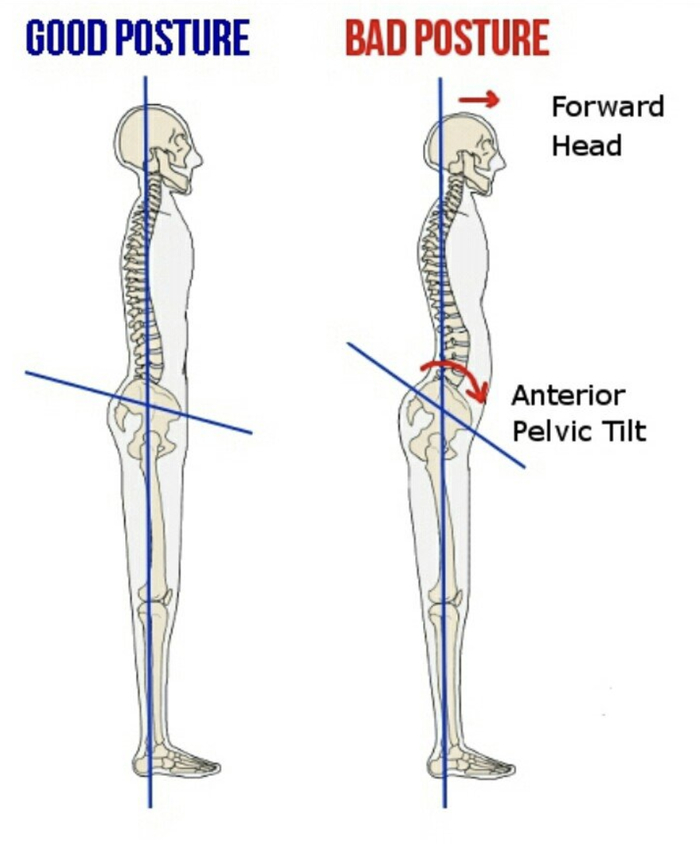 ภาวะกระดูกเชิงกรานคว่ำ