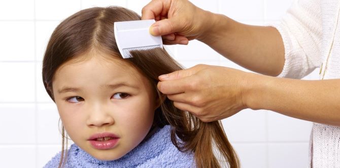 Anak-Anak Kena Jangkitan Kutu Kepala? Ini Cara Menghilangkannya