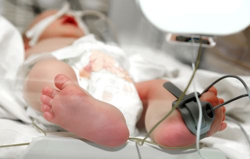 “3D Print” saved a baby's life