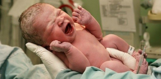 How to plan for a scheduled C-section