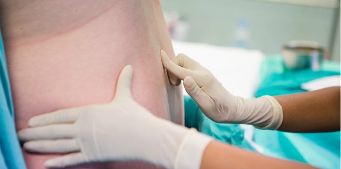 Pregnancy Concerns: Epidurals Complications