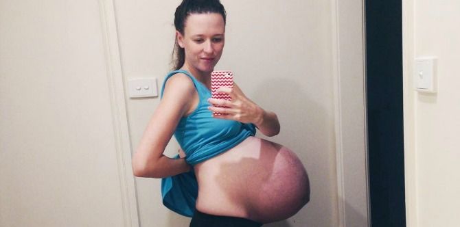 Her baby bump photo went viral, but for all the wrong reasons