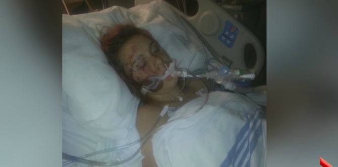 Pregnant Pokemon Go player given emergency C-section after being run over by van