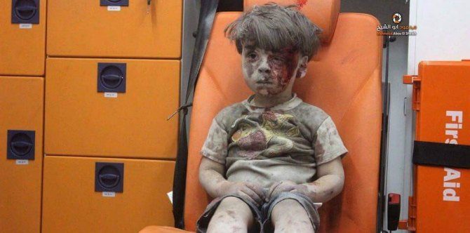 Heartbreaking photo of bloodied Syrian boy reminds us of the horrors of war