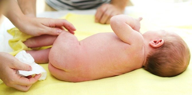 Benarkah Tisu Basah Penyebab Jangkitan Kuman Dalam Air Kencing Bayi?