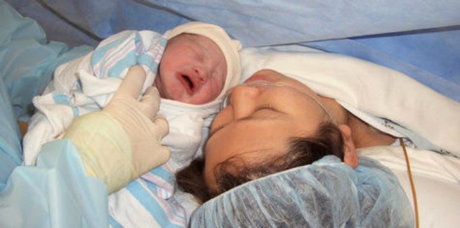 Tips To Recover From A C-Section