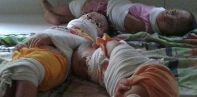 Kes Penderaan Kanak-Kanak, 4 Wanita Ditahan Selepas Tersebar Gambar Budak Taska Diikat