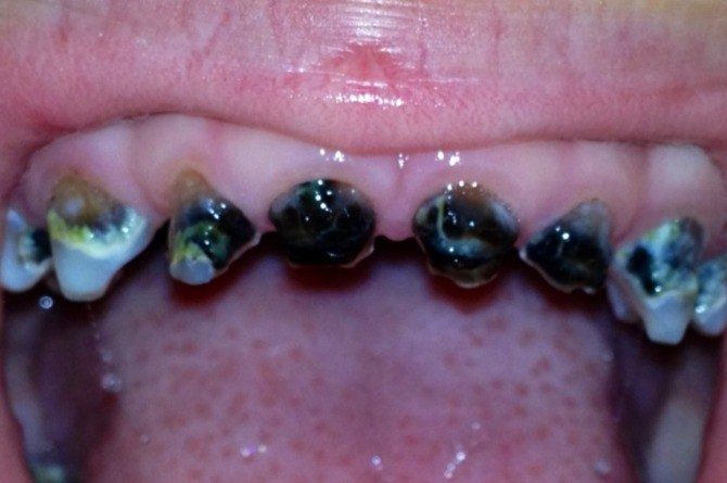 Kesilapan yang sering dibuat ibu bapa tanpa mereka sedar