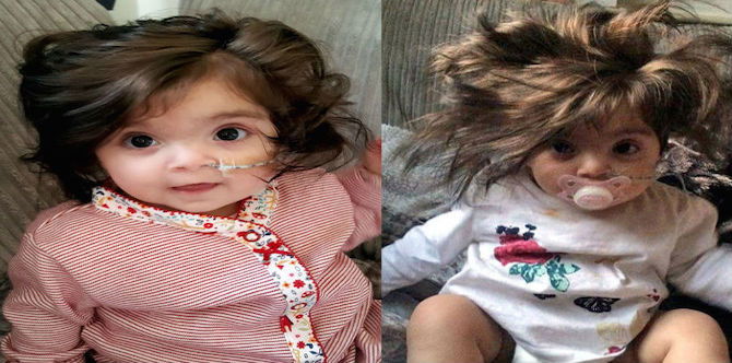 Ini Bukan Anak Patung – Dia Bayi 8-Bulan Dengan Rambut Ala Rapunzel!