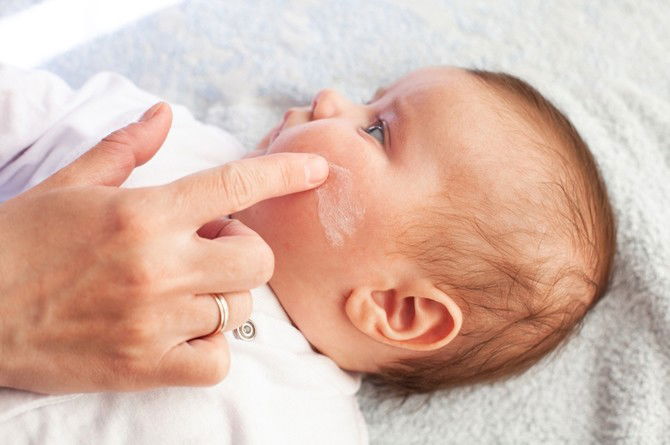 What Triggers Eczema? Here Are Some Common Causes & What Parents Can Do to Help Your Child