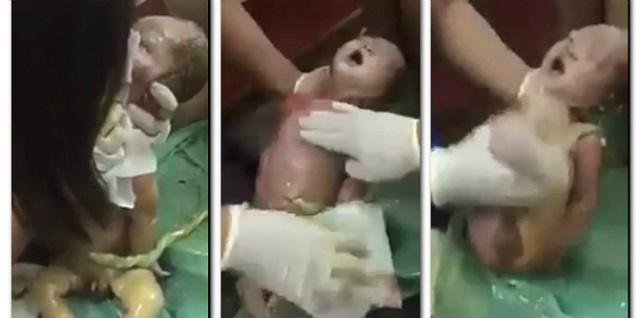 5 Minit Yang Mendebarkan! Seorang Doktor Cuba Menyelamatkan Bayi Yang Tak Bernafas Selepas Lahir