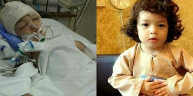 Koma akibat 'inflatable bouncer'