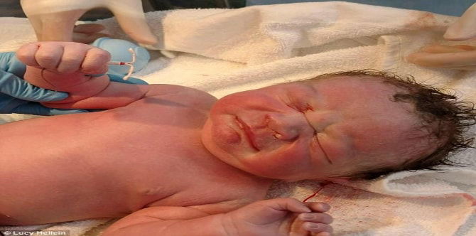 Gambar paling ironis di dunia? Bayi dilahirkan memegang implan yang bertujuan untuk MEMBERHENTIKAN ibunya daripada mengandung