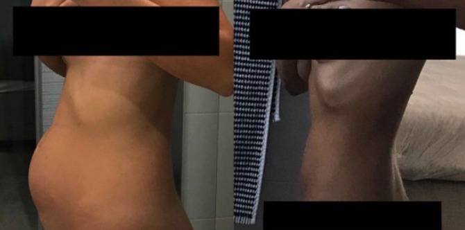 Endometriosis, Penyakit "Senyap" Yang Dihidap Ramai Wanita