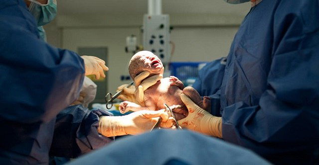 Soalan Yang Kerap Ditanya Tentang Pembedahan C-Section Dan Wajib Diketahui Ibu Hamil