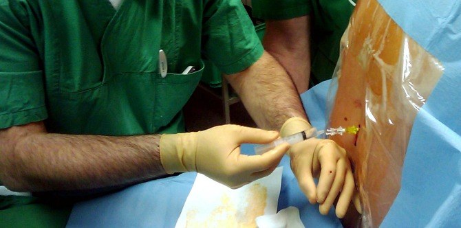 Suntikan Epidural TAK PATUT DIAMBIL sebab 9 perkara ini