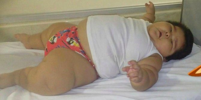 Bayi Lelaki Yang Baru Berusia 10 Bulan Ini Berat Hampir 30 kg!!