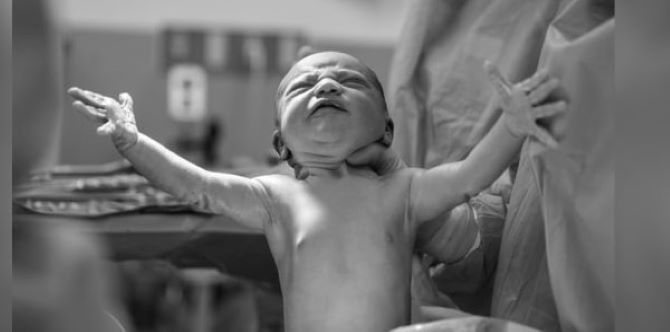 Bayi Pramatang Ini Lahir Tidak Menangis Seperti Bayi Normal Lain, Petanda Bayi Lemas