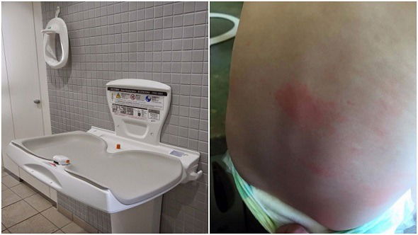 Amaran Buat Ibu Bapa: Lihat Dulu Alas Tukar Lampin Bayi Di Tandas Awam Atau Jadi Begini...