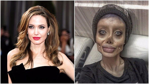 Obses nak jadi Angelina Jolie, remaja ini sanggup buat 50 pembedahan plastik