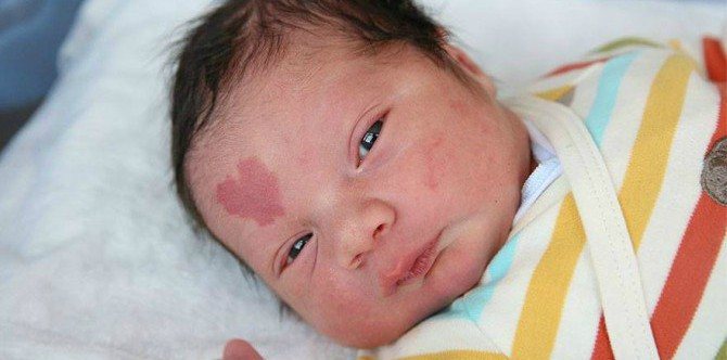 Bayi ini mempunyai tanda lahir berbentuk love yang comel sekali!