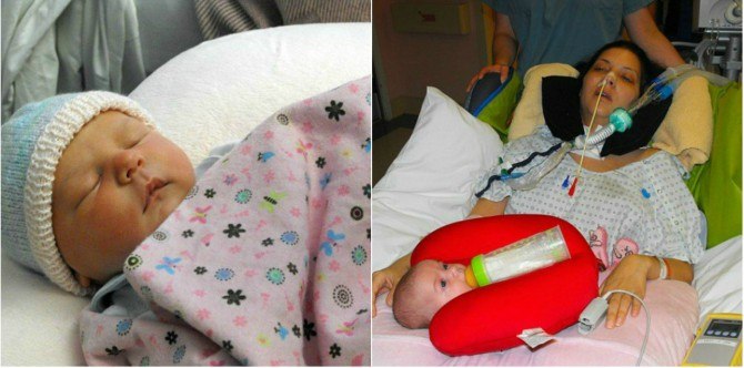 Sindrom Guillain-Barre menyebabkan ibu ini lumpuh selepas bersalin c-sec!