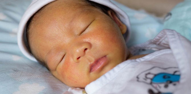 Bacaan Kuning Bayi (Jaundice): Tanda, Risiko & Rawatan Untuk Hilangkan Kuning Bayi Yang Berkesan