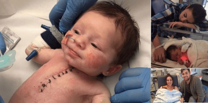 Usia baru 1 minggu, tapi bayi ini menghidap 4 masalah jantung dan terpaksa jalani pembedahan!